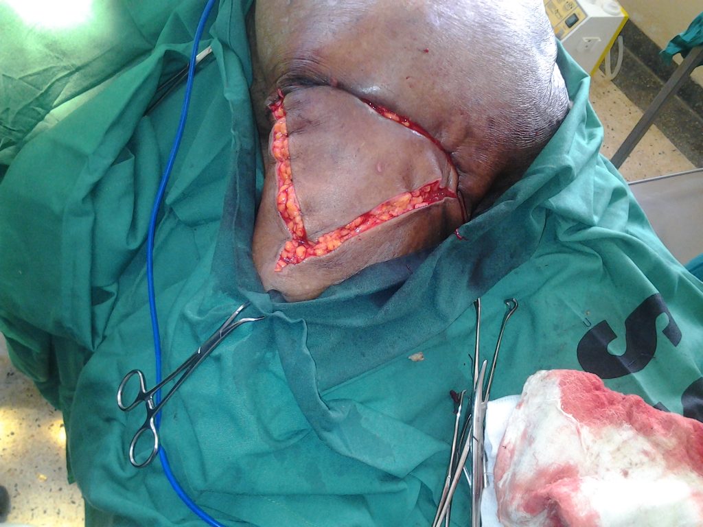 Orthopedic Surgeries